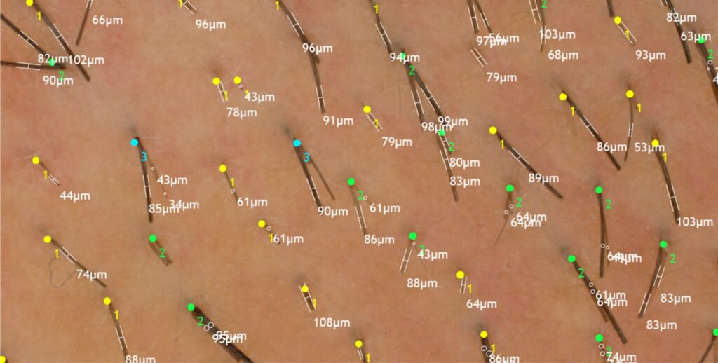 data obtained for trichoscopic consultations